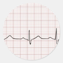 Battement de coeur d'ECG sur le papier de graphiqu Adhésifs