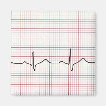 Battement de coeur d'ECG sur le papier de graphiqu Aimant Pour Réfrigérateur