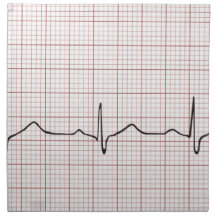 Battement de coeur d'ECG sur le papier de graphiqu Serviette