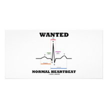 Battement de coeur normal voulu (électrocardiogram cartes avec photo
