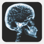 CERVEAU DE CRÂNE DE RAYON X - BLEU AUTOCOLLANT