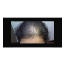 Cheveux T Photocarte Personnalisée