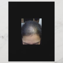 Cheveux T Prospectus En Couleur
