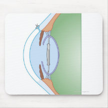 Chirurgie de cataracte tapis de souris