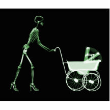 FEMME DE RAYON X ET VOITURE D'ENFANT SQUELETTIQUES PHOTO SCULPTURE