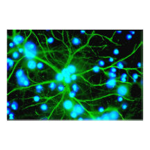 L'astrocyte sont les cellules de Glial en forme d' Impression Photographique