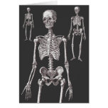 Les squelettes sont hors du cabinet ! Carte de voe