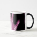 Main rose de squelette de rayon X Mugs