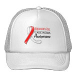 Ruban de conscience de carcinome malpighien casquette