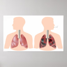 Tabagisme et affiche de cancer de poumon