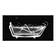 Temps squelettique de Bath du rayon X B&W Cartes Avec Photo