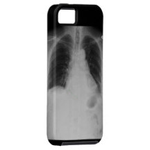 X Vibe de Casemate de l'iPhone 5 de ~ de rayon Coques iPhone 5