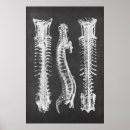 Recherche de vertébral posters Toute personne