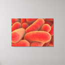 Recherche de pathologie art Organisme