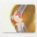 Recherche de rayons x tapis souris Partie du corps humain