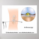 Recherche de chirurgical posters Chirurgie