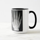 Recherche de rayons x tasses Toute personne