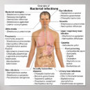 Recherche de human posters Chart