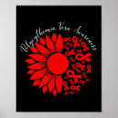 Recherche de sclérose en posters Soutien