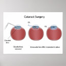 Recherche de chirurgie posters Remplacement