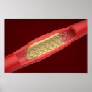 Recherche de cardiologie posters Cœur