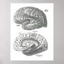Recherche de neurologique posters Docteur