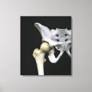 Recherche de articulation art Médecine