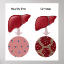 Recherche de digestif posters Digestion