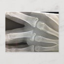 Recherche de x ray vœux cartes Os
