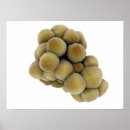 Recherche de tumeur posters Oncologie