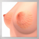 Recherche de imagerie médicale posters Organe