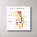 Recherche de articulation art Soins de santé