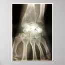 Recherche de os de la main posters Médecin
