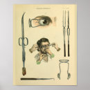 Recherche de chirurgie art Vintage