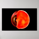 Recherche de yeux humains posters Ophtalmologie