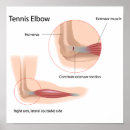 Recherche de blessure posters Bras