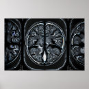 Recherche de neurosciences posters Médecine