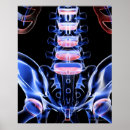 Recherche de imagerie médicale posters Image de rayons x