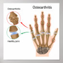 Recherche de chiropractic posters Doctor