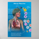 Recherche de lymphocyte Anticorps