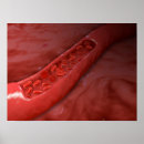 Recherche de biologie moléculaire posters Détail