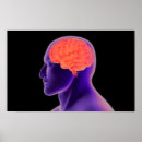 Recherche de neurosciences posters Médecine