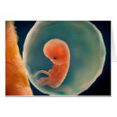 Recherche de placenta Enceinte