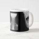 Recherche de rayons x tasses Docteur
