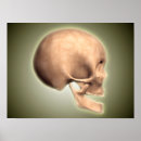 Recherche de cavité posters Médecine