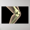 Recherche de rayons x posters Santé