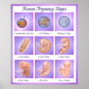 Recherche de foetus posters Grossesse