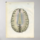 Recherche de neurologique posters Cerveau