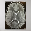 Recherche de radiologie posters Radiologue