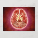 Recherche de nerfs cartes postales Numériquement image générée